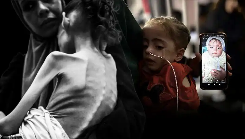 Küçük Meryem’in Dramatik Hikayesi: 25 Kilodan 10 Kiloya Düşen Minik Kahraman