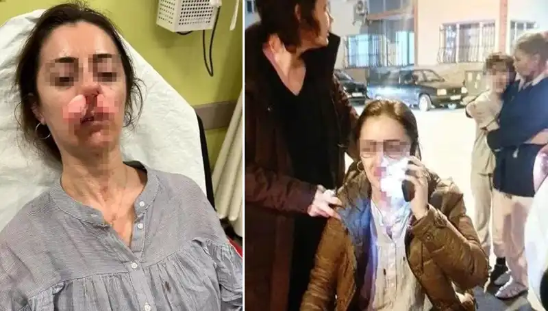 Eşinin Erkeğine Olan Kızgınlığını Otomobil Kapısıyla İfade Etti