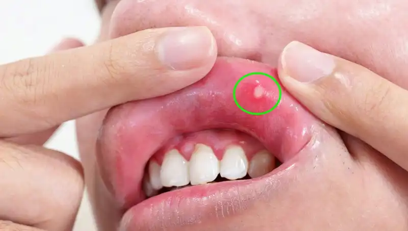 B Vitaminleri Eksikliği Belirtileri: Vücudunuzu Dinleyin, Sağlığınızı Koruyun!
