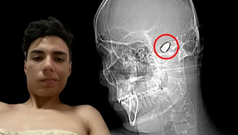 Kafasında Patlayan Düşünceler: Genç Adamın Zorlu Mücadelesi